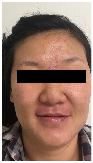 damaged skin before and after